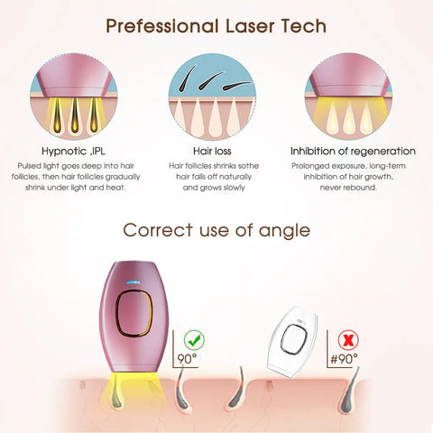 IPL Laser Hair Removal Portable / جهاز إزالة الشعر بالليزر القابل للحمل